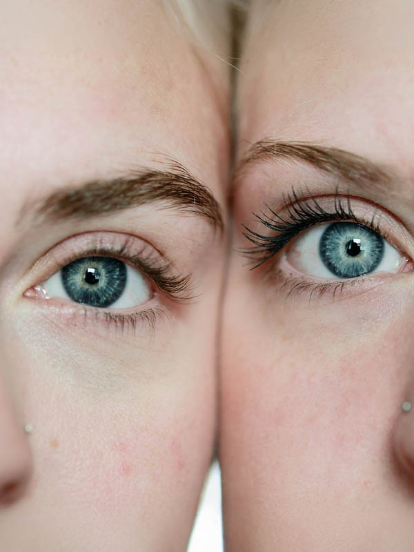 De mest almindelige øjensygdomme